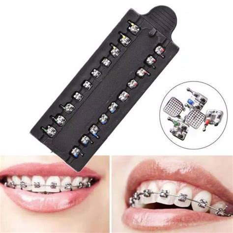 kawat gigi bracket metal mini orthodontic|kawat gigi keramik.